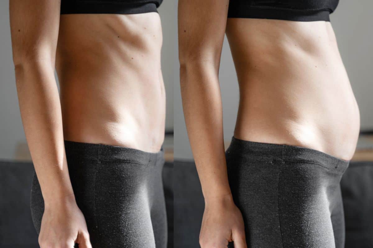 How long does diastasis recti take to improve West Acton?