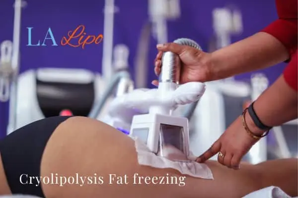 women getting fat freezing West Acton
