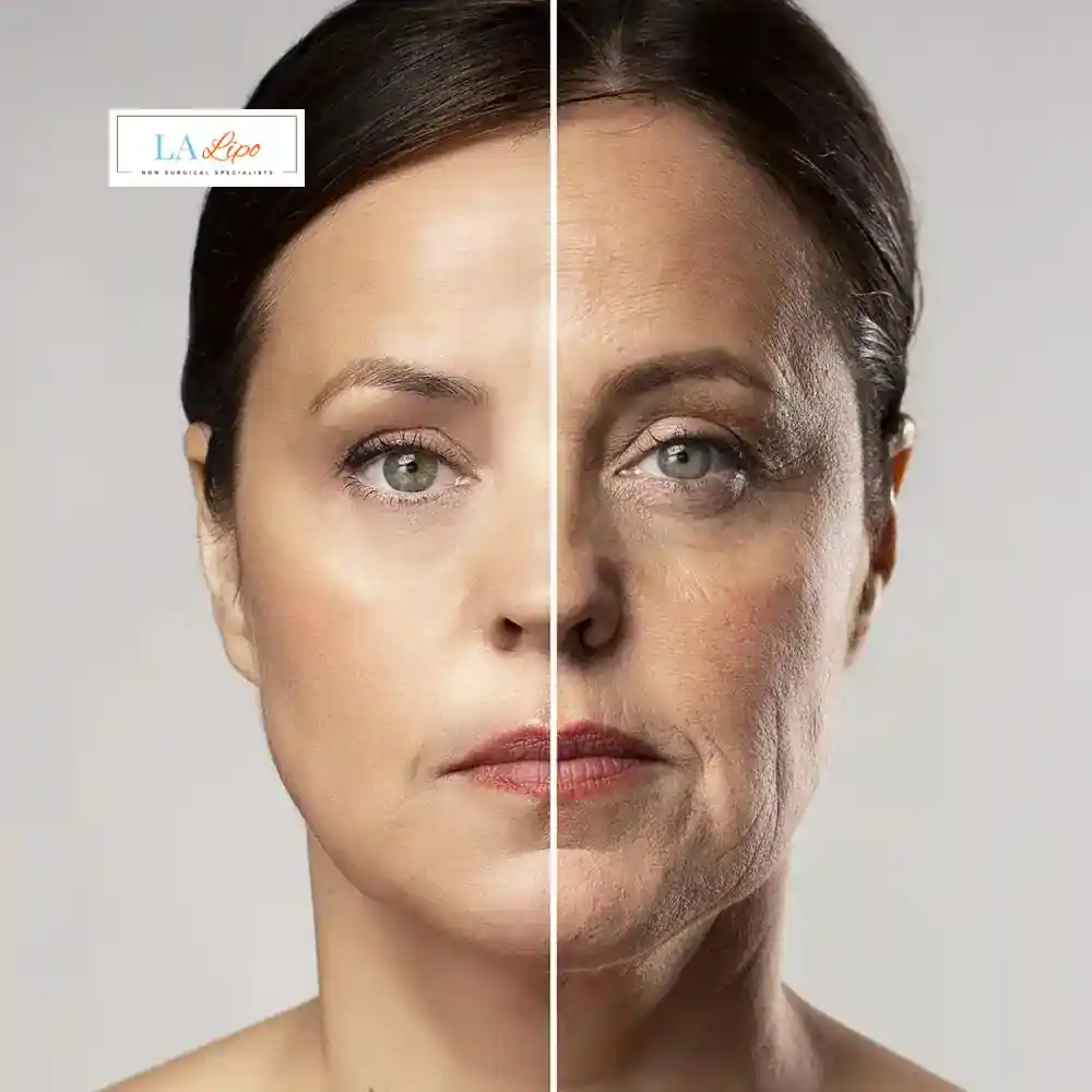 How Can You Tell If Non-Surgical Skin Tightening Is Right for You West Acton?